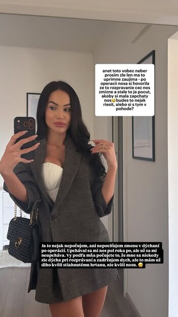 Full leaked Anet slotova private onlyfans photo