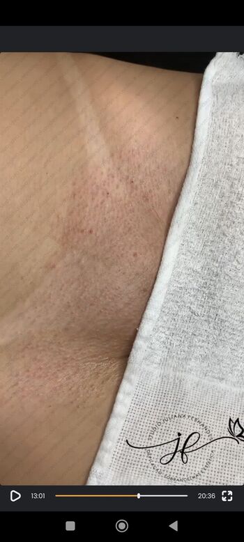 Full leaked Bronzeamento natural private onlyfans photo