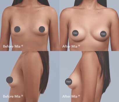 Full leaked Mia femtech private onlyfans photo