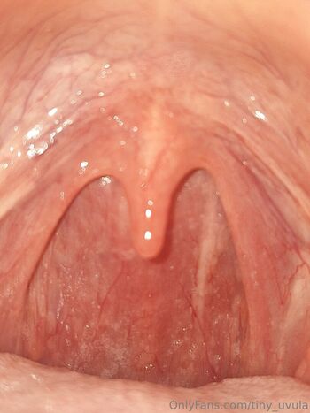 tiny_uvula