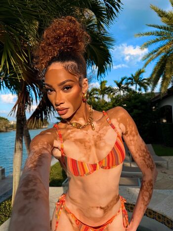 Full leaked Winnie harlow page private onlyfans photo