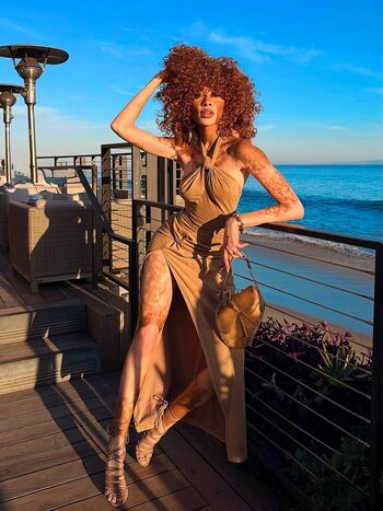 Full leaked Winnie harlow private onlyfans photo